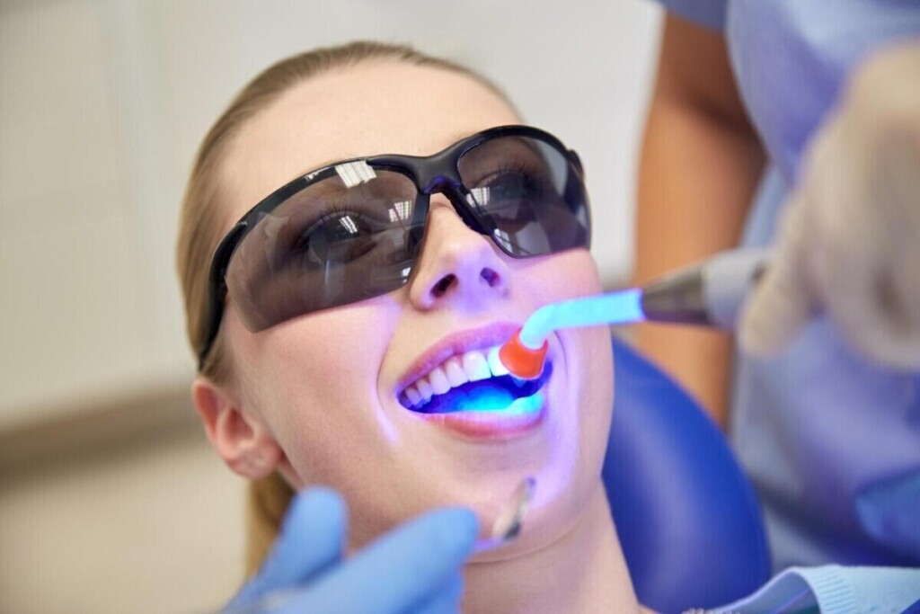 Blanqueamiento Dental en Casa vs Profesional: ¿Cuál es Mejor? Blanqueamiento Dental en Casa vs Profesional: ¿Cuál es Mejor?