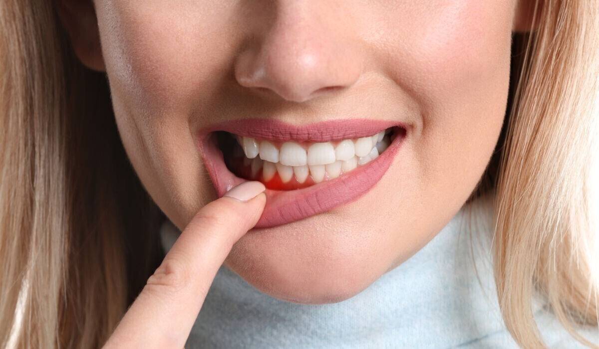 Urgencias Dentales 24 Horas en México Urgencias Dentales 24 Horas en México